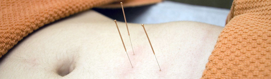 Accupuncture, Eastern Healing Arts in the Lansdale, Montgomery County PA area